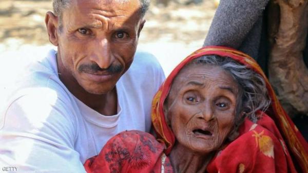 الامم المتحدة تحذر من مجاعة في اليمن