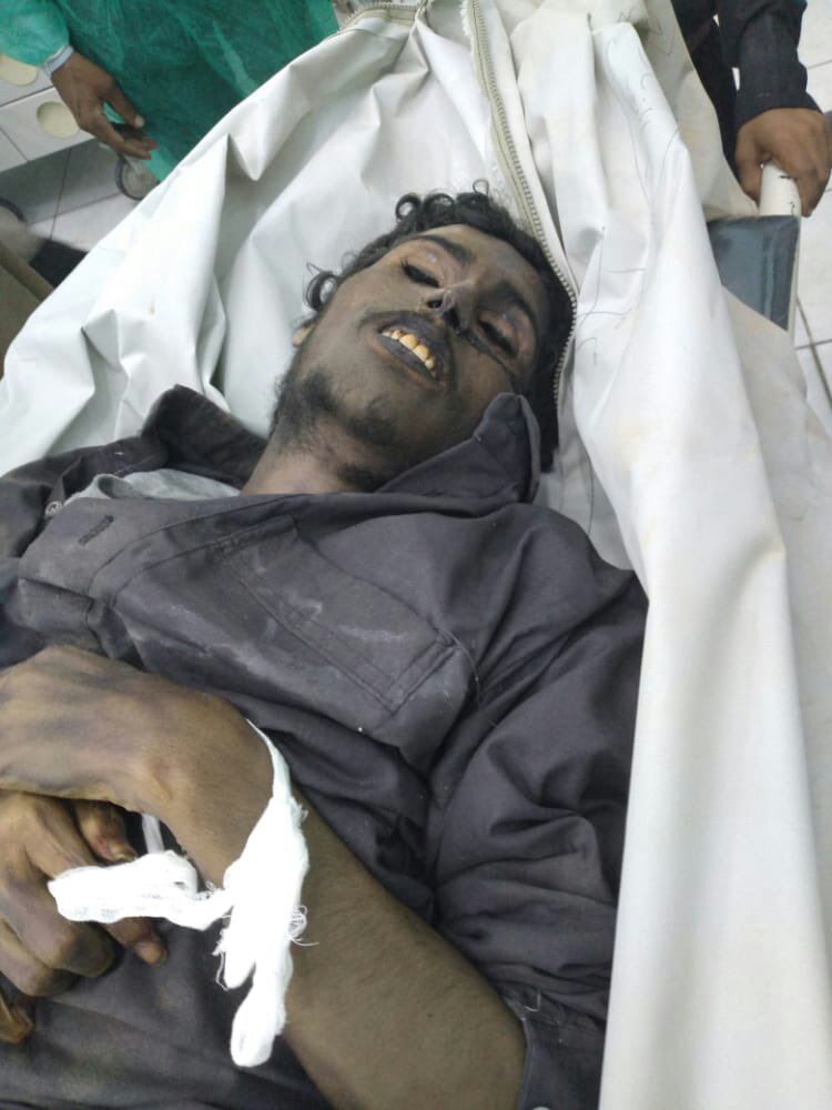 وفاة الاسير الصباري تحت التعذيب في سجون مليشيات الحوثي الأربعاء 30 سبتمبر 2020