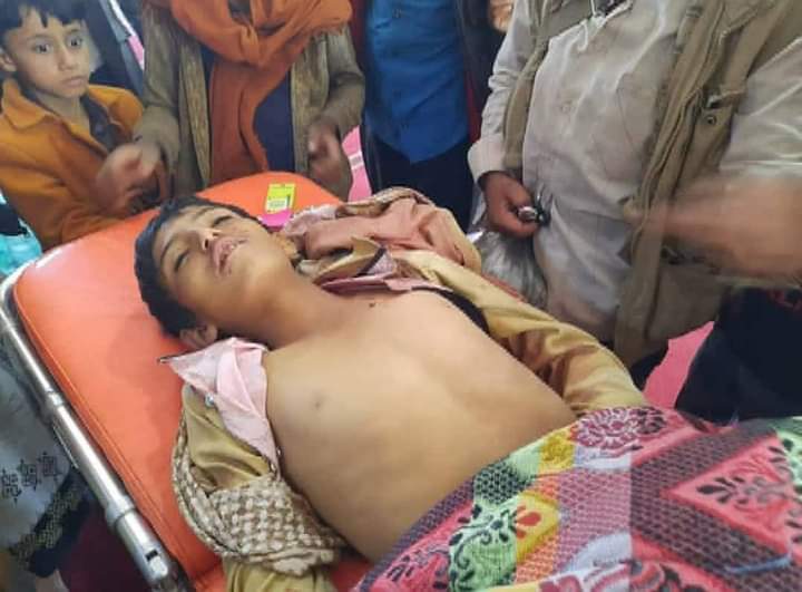 استشهاد طفل برصاص قناص حوثي في الضالع
