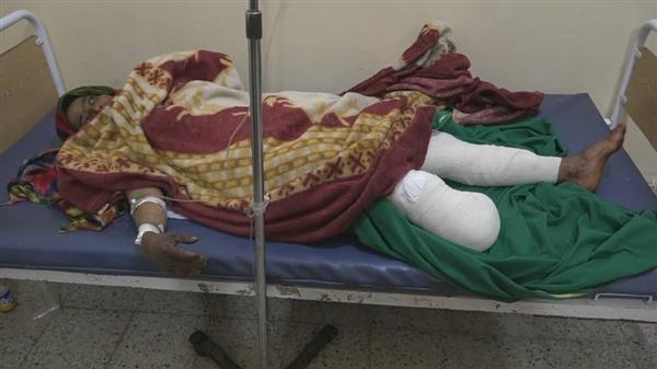 إصابة امرأة بانفجار لغم حوثي في جبل حبشي بتعز